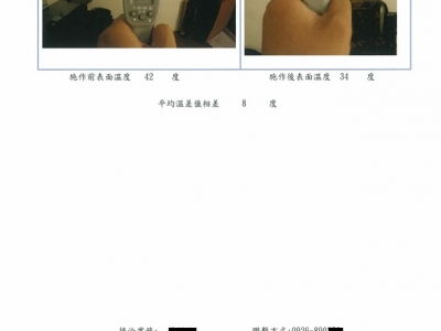 Before 42℃↘ After 34℃