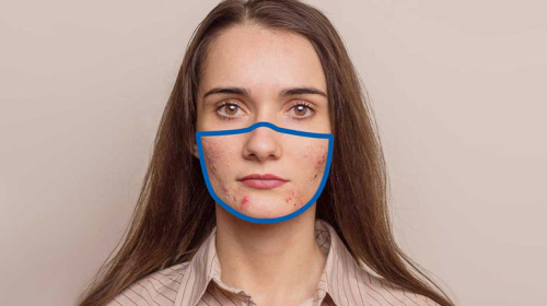 Maskne,-why-your-face-is-breaking-out-under-your-mask-and-how-to-stop-it