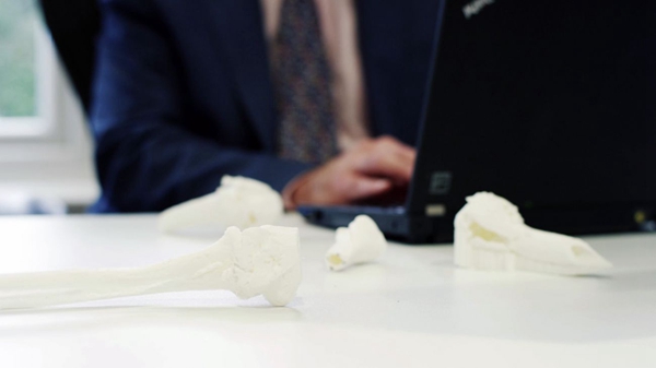 医疗健康领域应用3D打印，3D打印案例