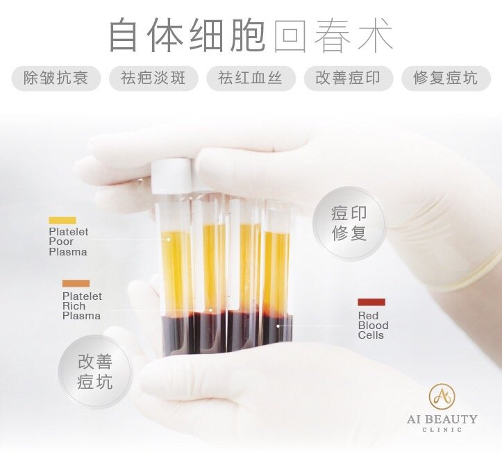 Ai Beauty Clinic 英国伦敦医美整形诊所 Prp自体血清嫩肤