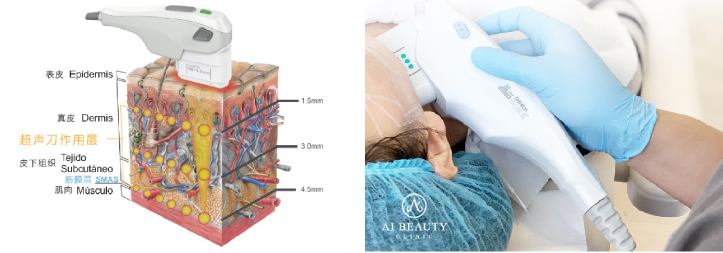 Ai Beauty Clinic 英国伦敦医美整形诊所 逆龄黑科技超声刀vs热玛吉无创抗衰到底选谁