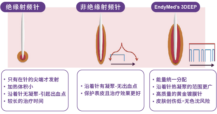 射频黄金微针 射频黄金微针